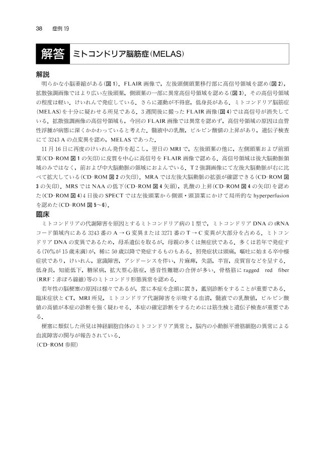 症例から学ぶ神経疾患の画像と病理 症例から学ぶ神経疾患の画像と病理_立読み