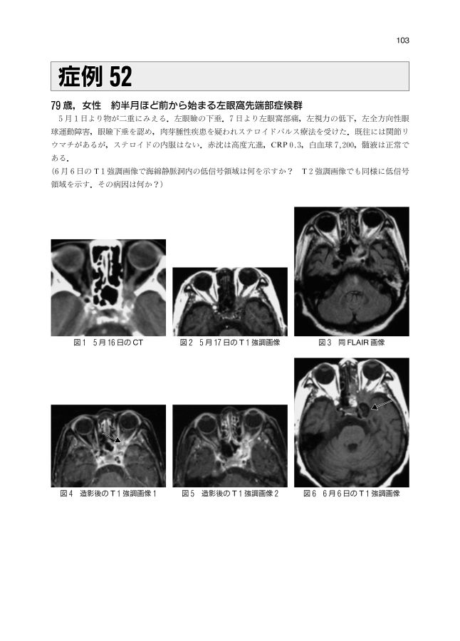症例から学ぶ神経疾患の画像と病理 症例から学ぶ神経疾患の画像と病理_立読み