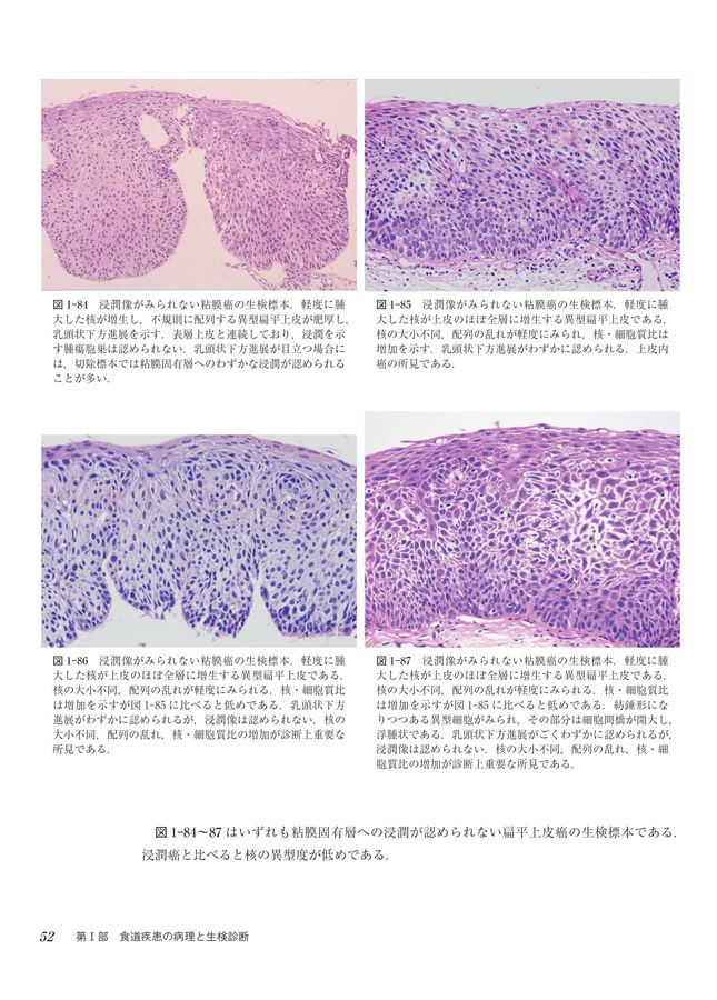 消化管の病理と生検診断_立読み