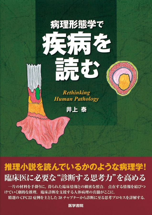 病理形態学で疾病を読む_立読み