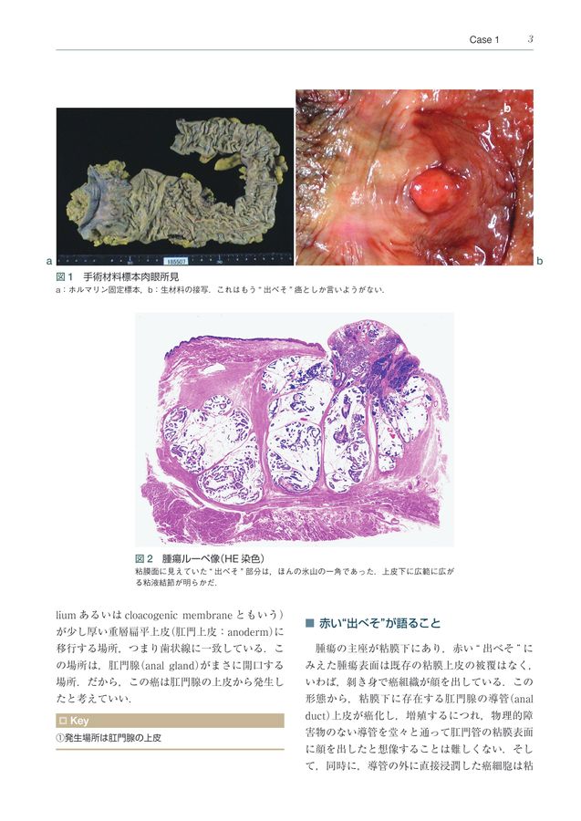 病理形態学で疾病を読む 病理形態学で疾病を読む | 井上 泰 |本 | 通販 | Amazon