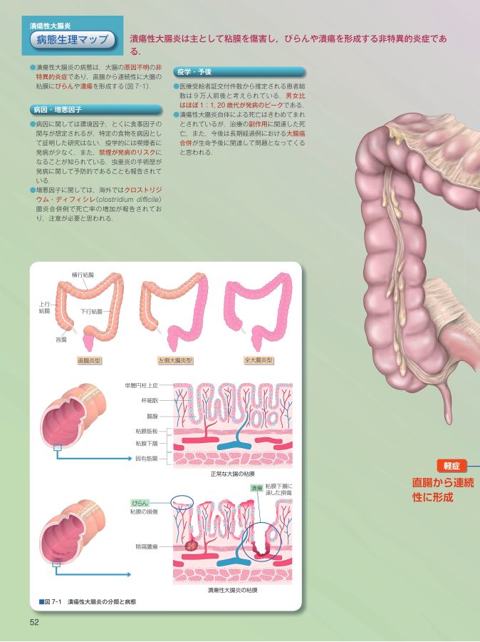 病態生理　ビジュアルブック 病態生理ビジュアルマップ[4] | 書籍詳細 | 書籍 | 医学書院
