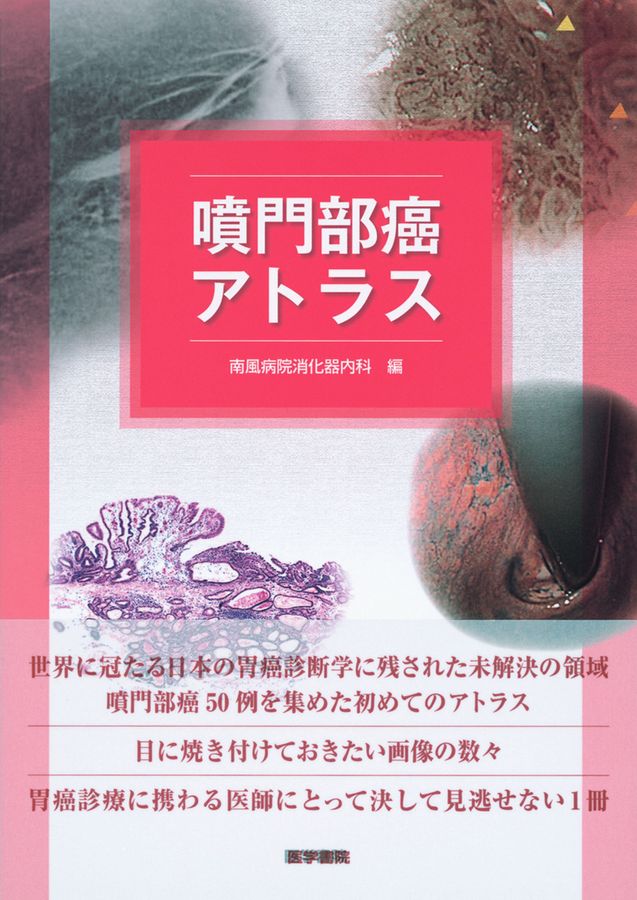 噴門部癌アトラス_立読み