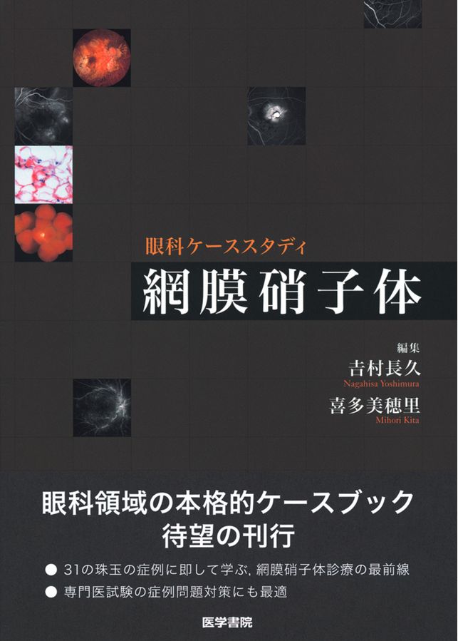 眼科診療のスキルアップ 網膜硝子体編 網膜硝子体_立読み