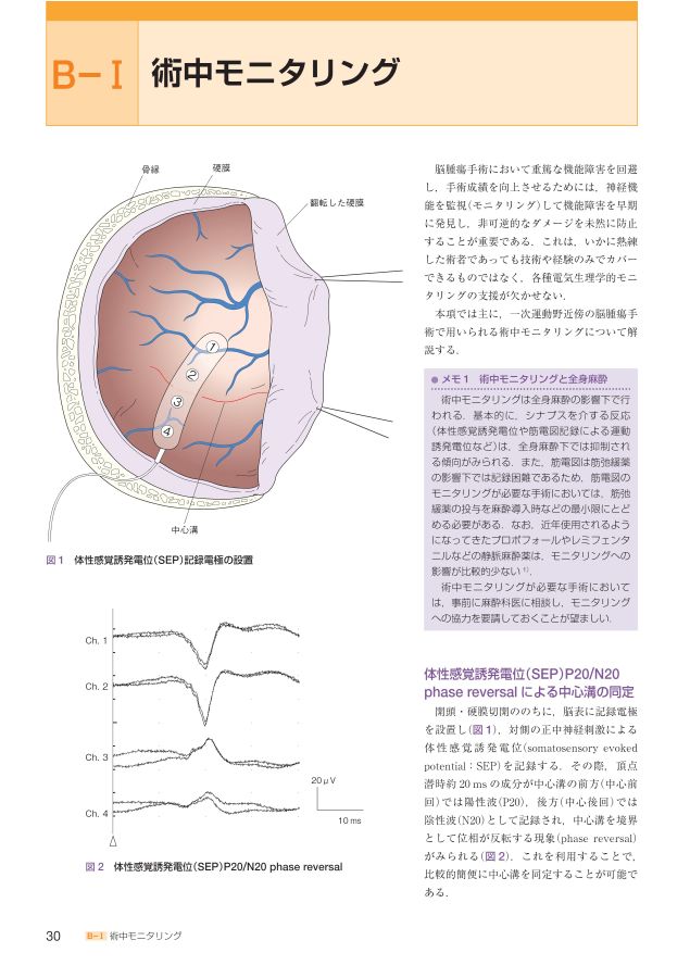 01104_イラストレイテッド脳腫瘍外科学_立読み