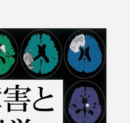 脳血管障害と神経心理学 第2版 脳血管障害と神経心理学 第2版 | 平山 惠造 |本 | 通販 | Amazon
