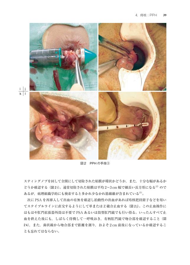 大腸肛門病ハンドブック | 大腸肛門病ハンドブック 中古本・書籍 必携! メジカルビュー社|消化器外科|肛門疾患の診かた 紀伊國屋書店ウェブ 大腸肛門病ハンドブック | 大腸肛門病ハンドブック 中古本・書籍 必携! メジカルビュー社|消化器外科|肛門疾患の診かた 紀伊國屋書店ウェブ
