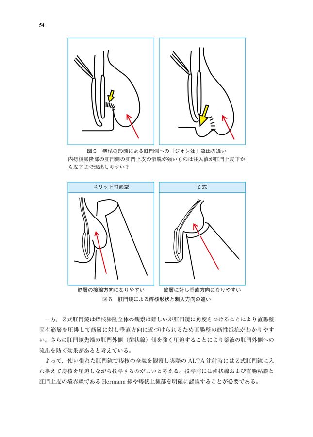 大腸肛門病ハンドブック_立ち読み
