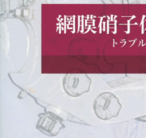 (裁断済み)網膜硝子体手術SOS 楽天市場】網膜硝子体手術sosの通販