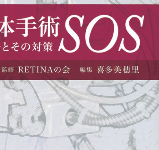 (裁断済み)網膜硝子体手術SOS 楽天市場】網膜硝子体手術sosの通販