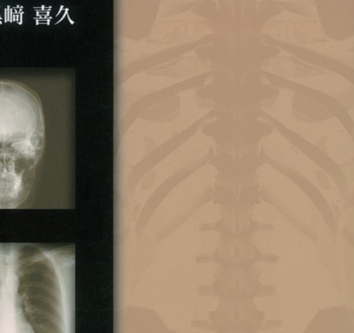 裁断済み　単純X線写真の読み方・使い方 単純X線写真の読み方・使い方 | 黒崎喜久 |本 | 通販 | Amazon