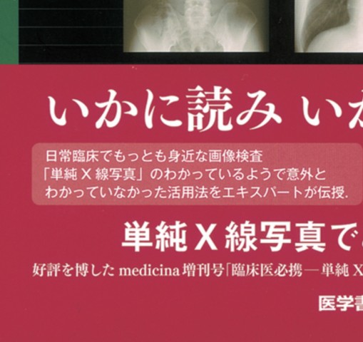 単純X線写真の読み方_立読み