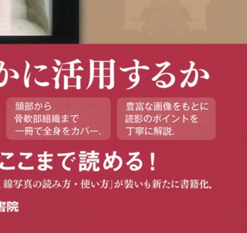 単純X線写真の読み方_立読み