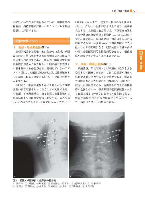 単純X線写真の読み方_立読み
