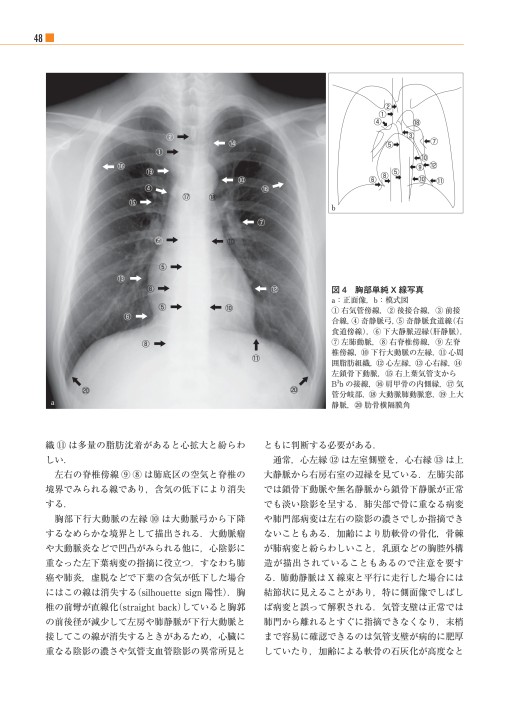 単純X線写真の読み方_立読み