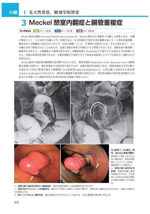 胃と腸アトラスII 下部消化管 第2版 胃と腸アトラスⅡ 下部消化管 第2版 | 書籍詳細 | 書籍 | 医学書院