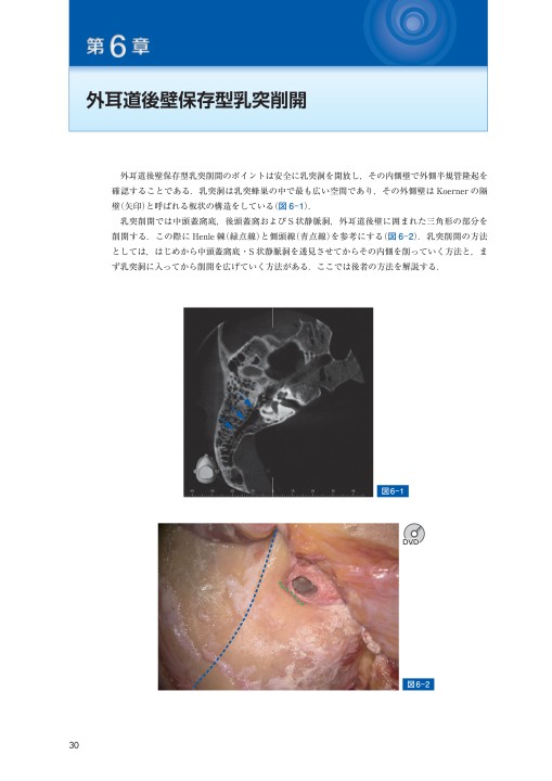 中耳側頭骨解剖ﾏﾆｭｱﾙ_立ち読み