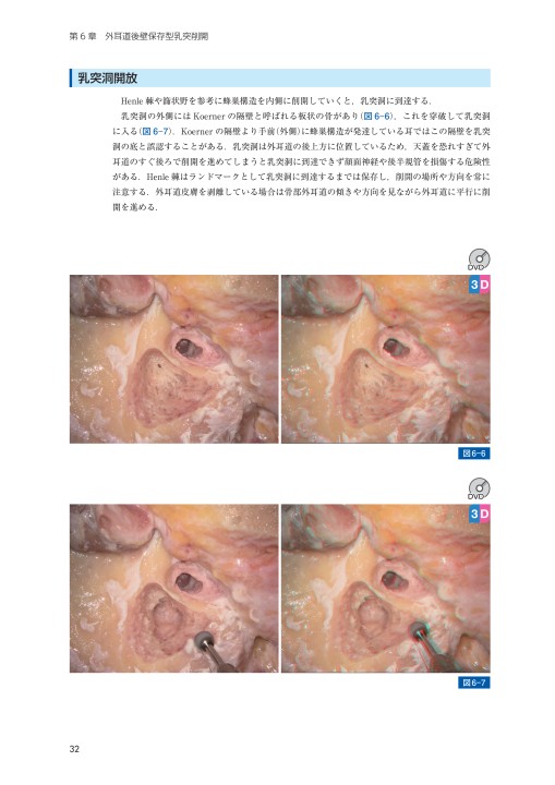 中耳側頭骨解剖ﾏﾆｭｱﾙ_立ち読み