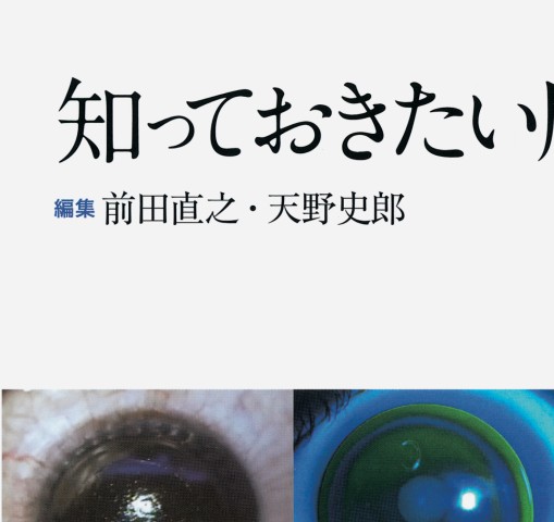 知っておきたい屈折矯正手術　裁断済 知っておきたい屈折矯正手術 [眼科臨床エキスパート] - 眼科専門書店