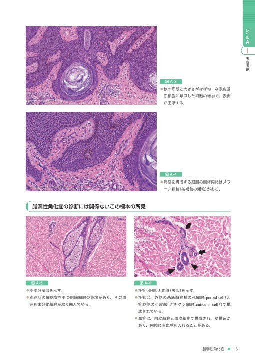 Amazon.co.jp: 実践! 皮膚病理道場 バーチャルスライドでみる