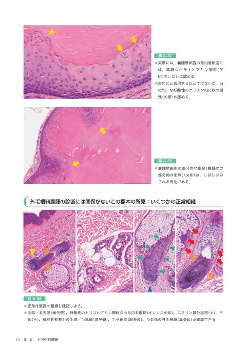実践！皮膚病理道場 バーチャルスライドでみる皮膚腫瘍』 立ち読み