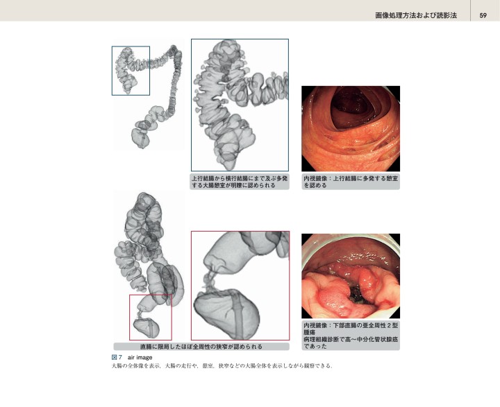 CT Colonography 実践ガイドブック』 立ち読み