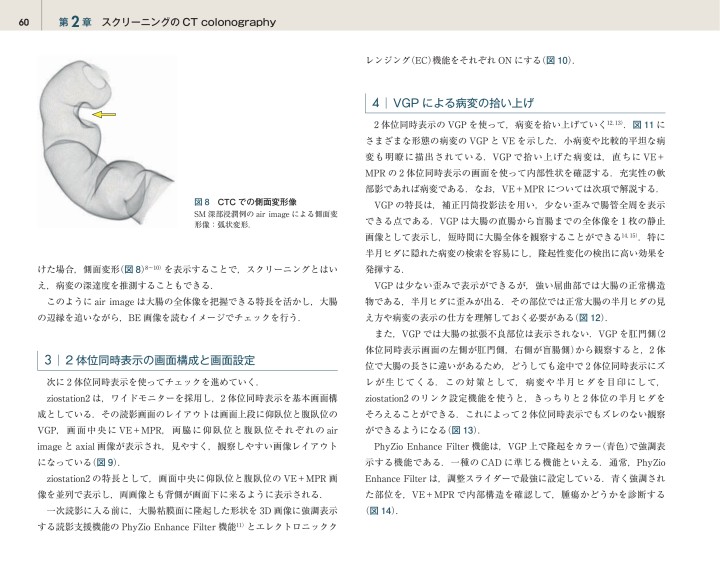 CT Colonography 実践ガイドブック CT Colonography 実践ガイドブック 新品本・書籍 | ブックオフ