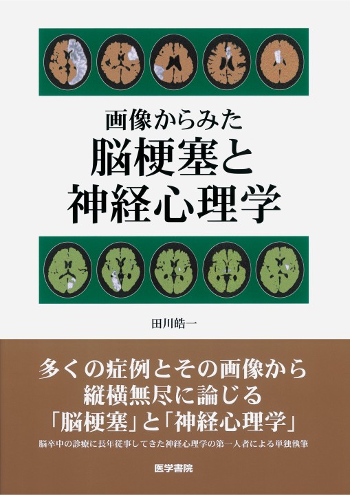 画像からみた脳梗塞と神経心理学』 立ち読み