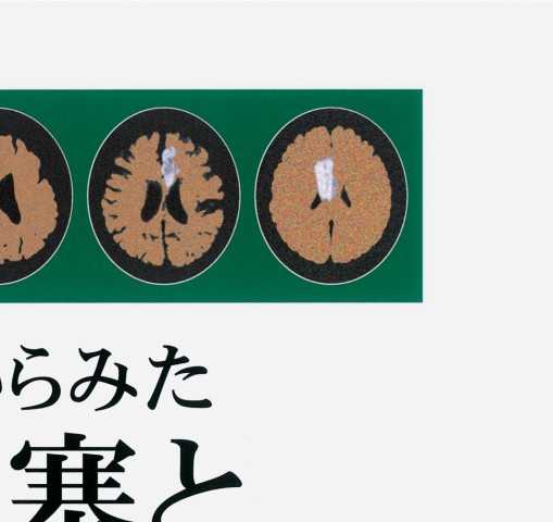 画像からみた脳梗塞と神経心理学 画像からみた 脳梗塞と神経心理学 | 田川 皓一 |本 | 通販 | Amazon