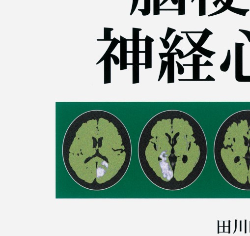 画像からみた脳梗塞と神経心理学』 立ち読み