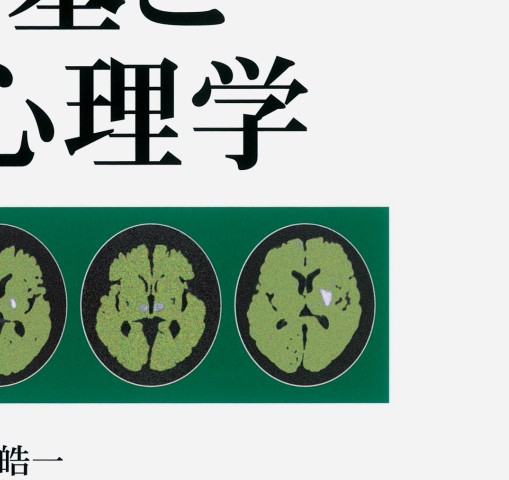 画像からみた 脳梗塞と神経心理学 画像からみた 脳梗塞と神経心理学 | 田川 皓一 |本 | 通販 | Amazon