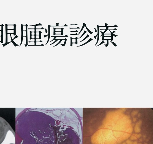 眼科臨床EX》知っておきたい眼腫瘍診療