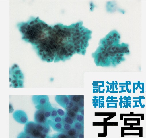 記述式内膜細胞診報告様式に基づく 子宮内膜細胞診アトラス