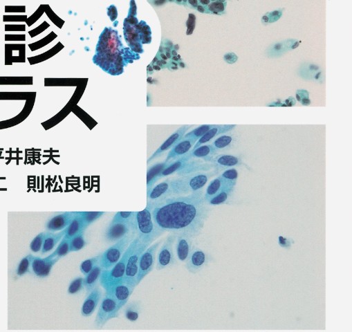 子宮内膜細胞診アトラス / 平井康夫/矢納研二 - 紀伊國屋書店