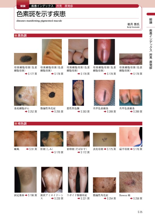 皮膚疾患ペディア 立ち読み