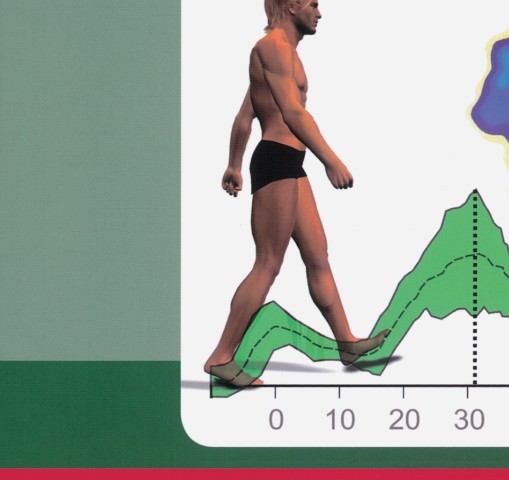 実践にいかす歩行分析_明日から使える観察・計測のポイント』立ち読み