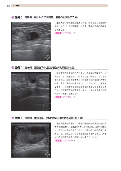 Chapter 1 乳腺の腫瘤性病変