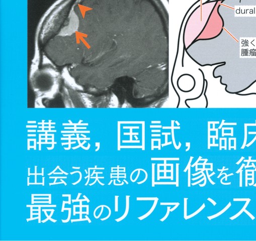 医学生・研修医のための画像診断リファレンス 立ち読み