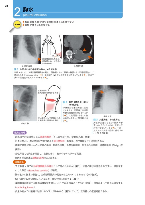 医学生・研修医のための画像診断リファレンス 立ち読み