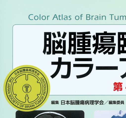 脳腫瘍臨床病理カラーアトラス 第4版』 立ち読み