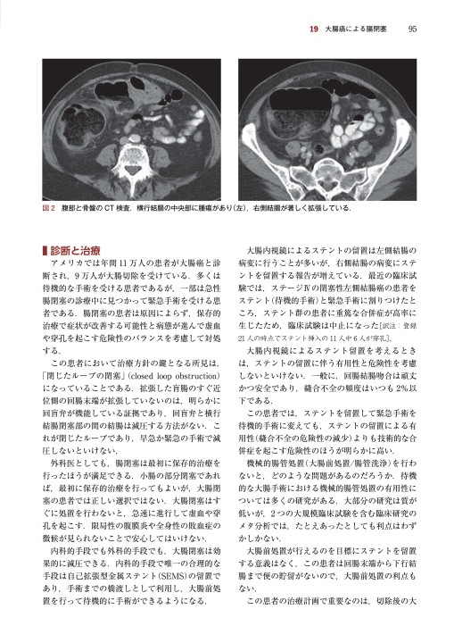 症例で学ぶ外科診療 Amazon.co.jp: 症例で学ぶ外科医の考えかた (外科診療の基本が