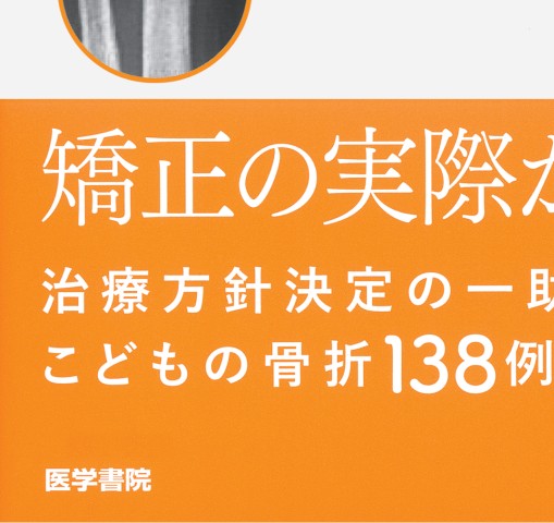小児骨折における自家矯正の実際 立ち読み