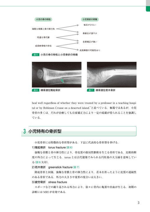 小児骨折における自家矯正の実際 立ち読み