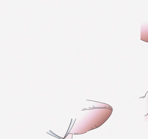 大阪日赤ラパロ教室］イラストで学ぶ腹腔鏡下胃切除［DVD付