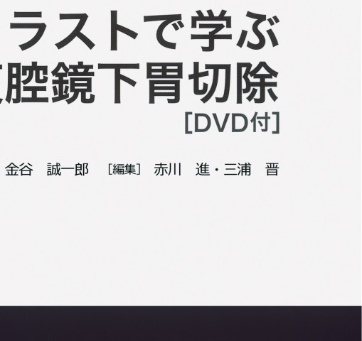 大阪日赤ラパロ教室 イラストで学ぶ腹腔鏡下胃切除 ｄｖｄ付 立ち読み