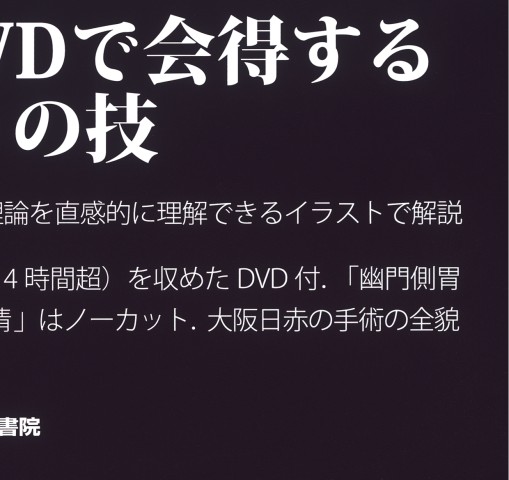 大阪日赤ラパロ教室 イラストで学ぶ腹腔鏡下胃切除 dvd付 立ち読み 大阪日赤ラパロ教室 イラストで学ぶ腹腔鏡下胃切除 dvd付 立ち読み