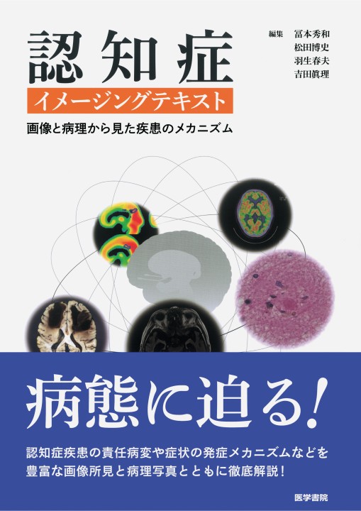 認知症イメージングテキスト－画像と病理から見た疾患の