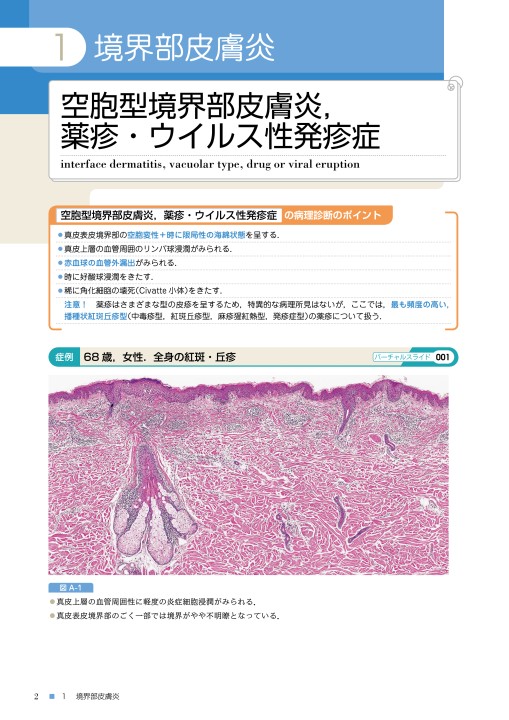 実践！ 皮膚病理道場2［Web付録付］ バーチャルスライドでみる炎症