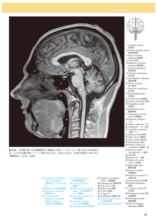 脳の機能解剖と画像診断 第2版 立ち読み