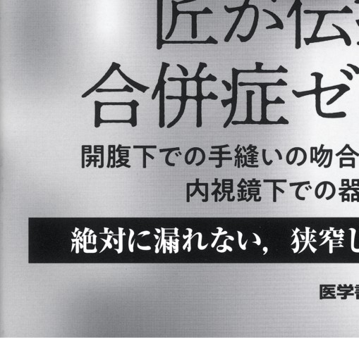 【裁断済】消化管吻合法バイブル 消化管吻合法バイブル [Web動画付] | 北島 政樹 |本 | 通販 | Amazon